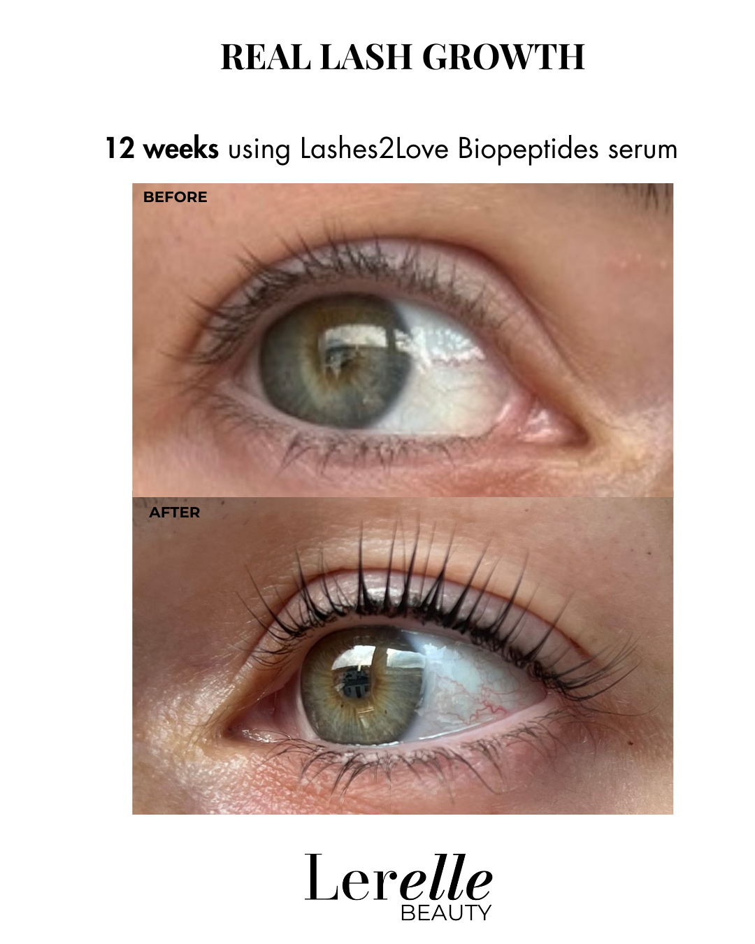 Sensitive Eye Growth Bundle – Lerelle Sensitive Eye Growth Bundle – Lerelle