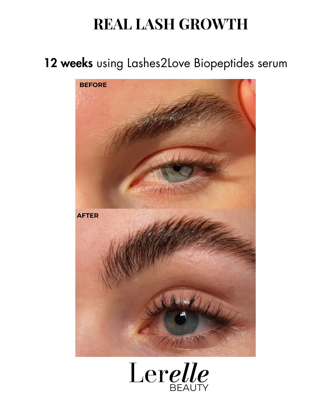 Before and after comparison of eye lashes using Lashes2Love Biopeptides serum by Lerelle Beauty.