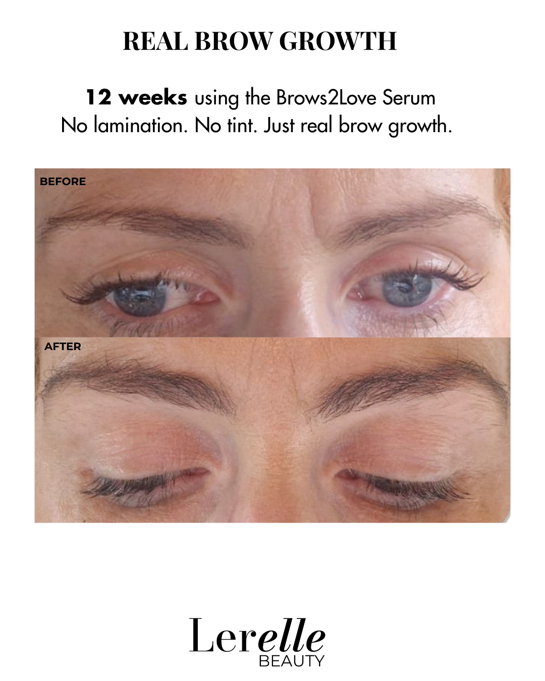 Brows2Love Brow Growth Serum