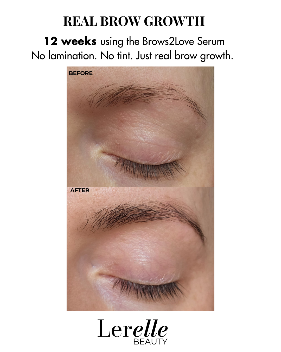Before and after comparison showing real brow growth after 12 weeks using Lerelle Beauty Brows2Love Serum