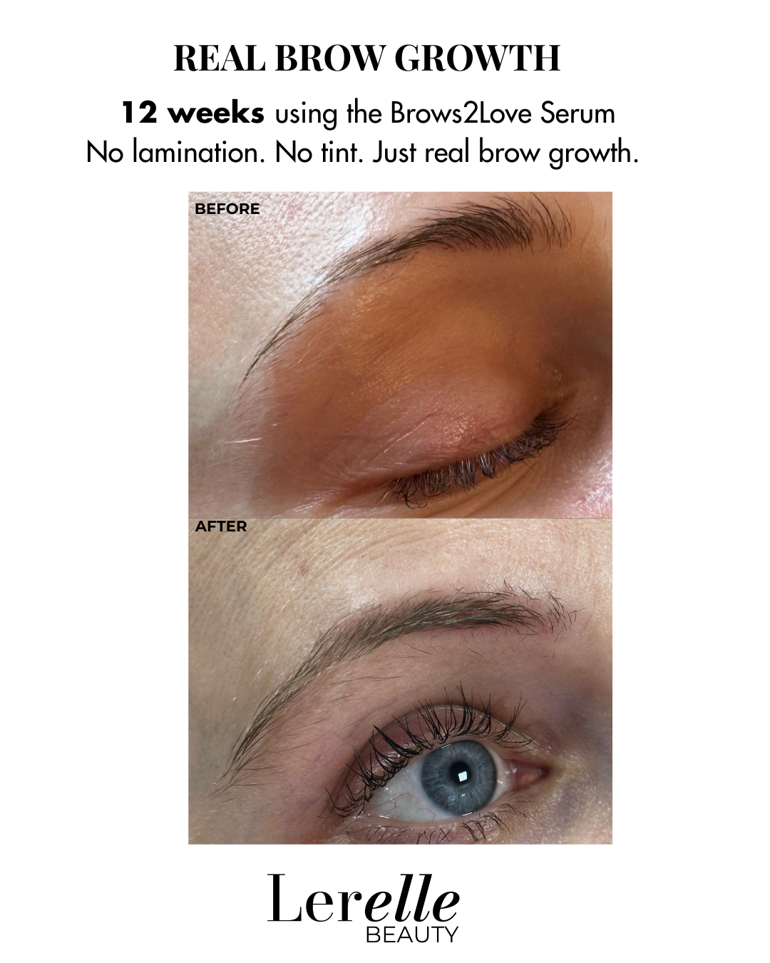 Lerelle Beauty Brows2Love eyebrow serum before and after, 12 weeks real brow growth, no lamination or tint.