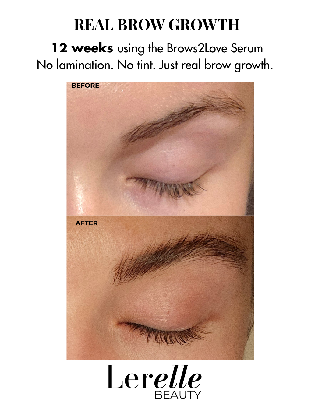 Lerelle Beauty Brows2Love eyebrow serum before and after, 12 weeks real brow growth, no lamination or tint.
