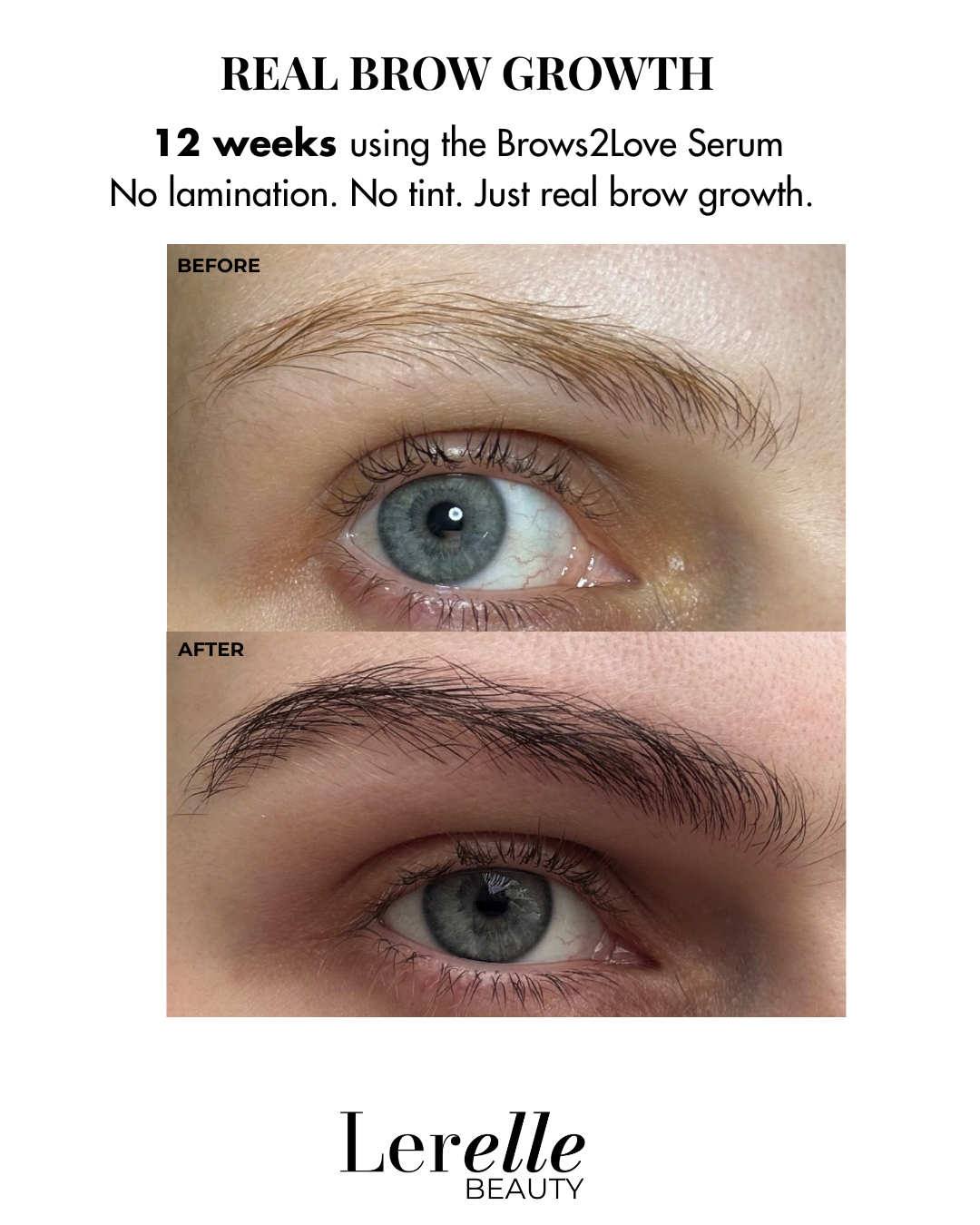 Lerelle Beauty Brows2Love eyebrow serum before and after, 12 weeks real brow growth, no lamination or tint.