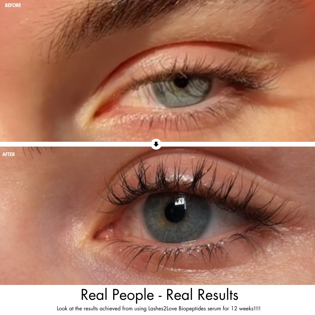 Lerelle Beauty Lashes2Love Biopeptides Lash Serum before and after comparison, 12-week results