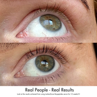 Lerelle Beauty Lashes2Love Biopeptides Lash Serum real customer before and after results