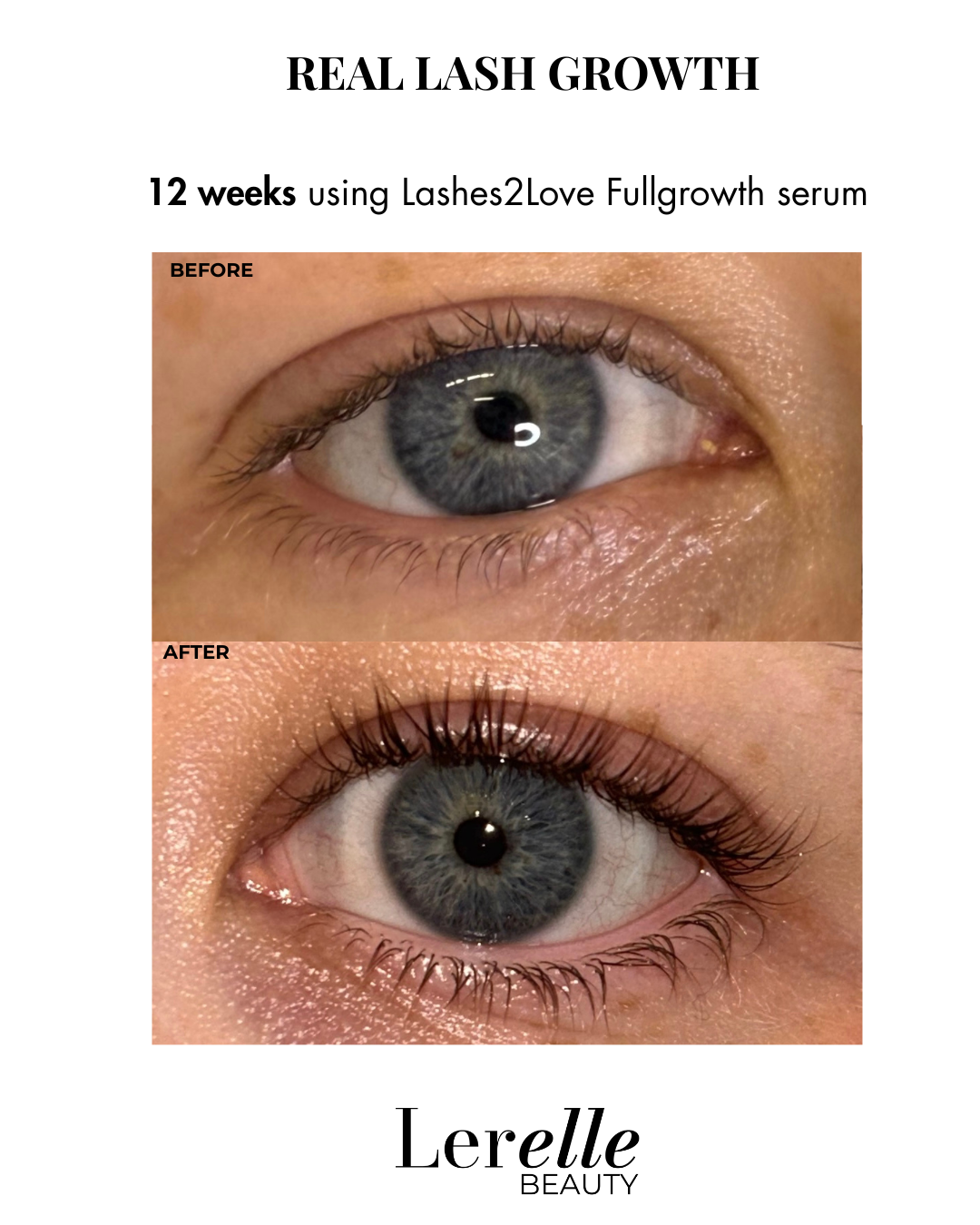Before and after comparison showing real lash growth after 12 weeks using Lerelle Beauty Lashes2Love FullGrowth serum