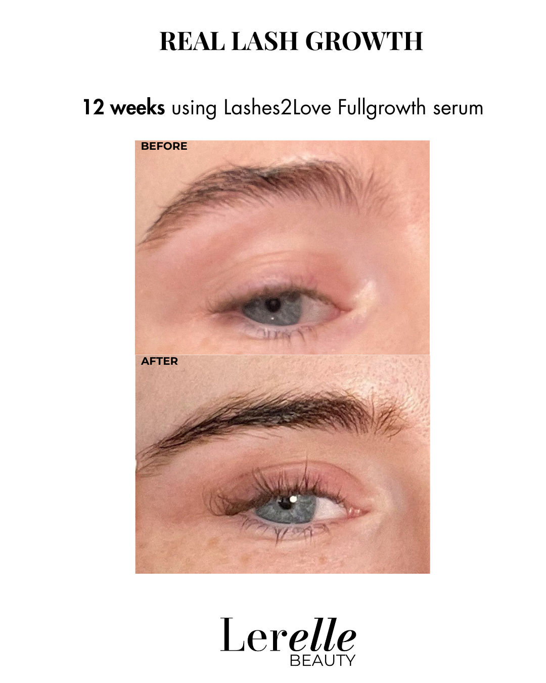 Lerelle Beauty Lashes2Love FullGrowth Lash Growth Serum before and after results after 12 weeks