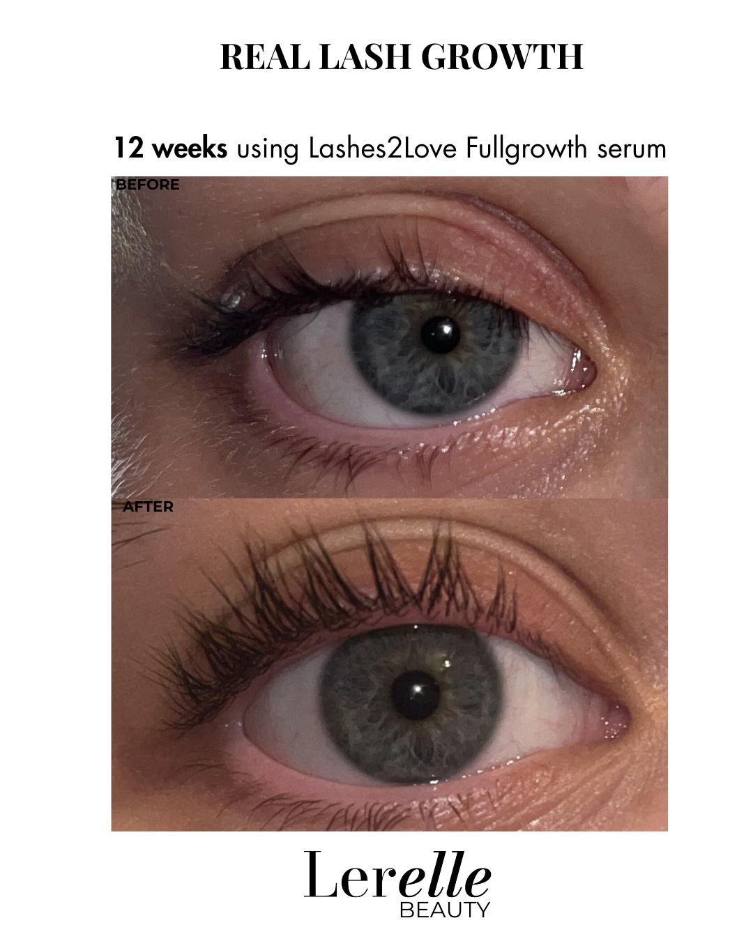 Lerelle Beauty Lashes2Love FullGrowth Lash Growth Serum before and after results after 12 weeks