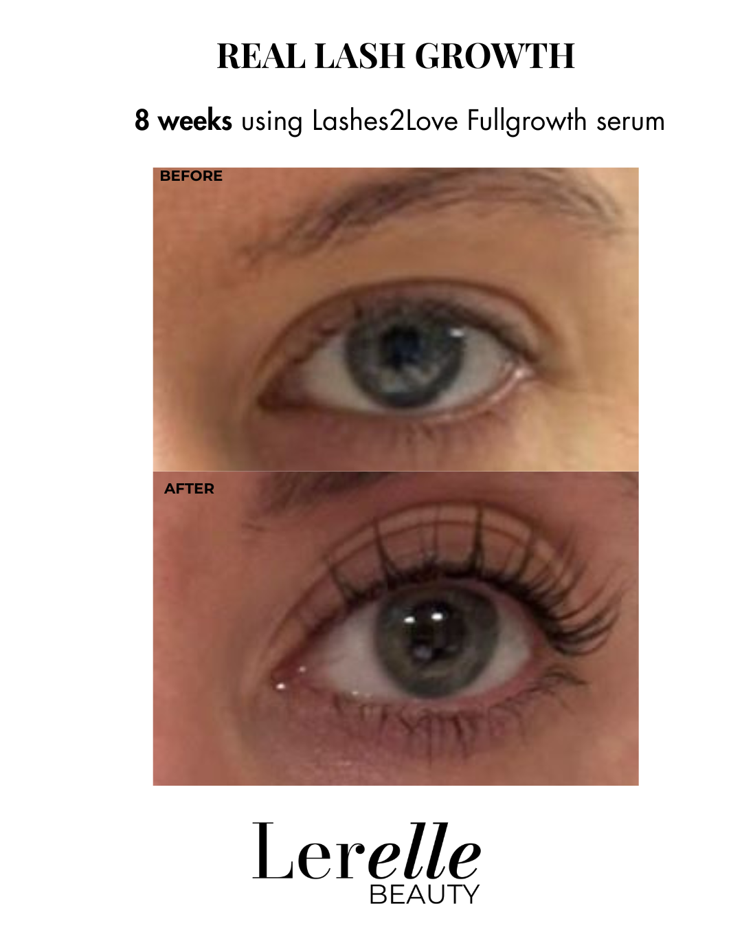 Before and after comparison showing real lash growth after 8 weeks using Lerelle Beauty Lashes2Love FullGrowth serum